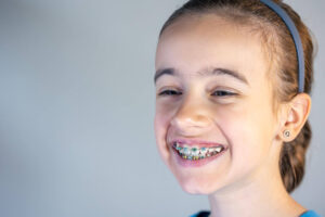 teenage girl with braces her teeth closeup smile 1 300x200