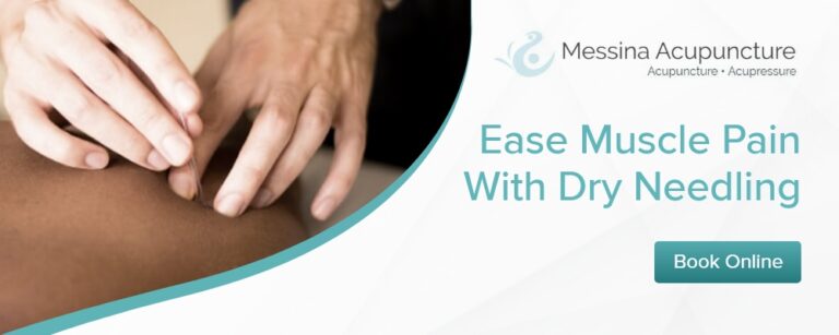 Messina Acupuncture graphics 1000 x 400 768x307