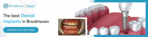 Brookhaven Dental Associates Graphic 1000x250 1 300x75